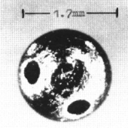 Diagram of the small metal pellet found in Georgi Markov's thigh.